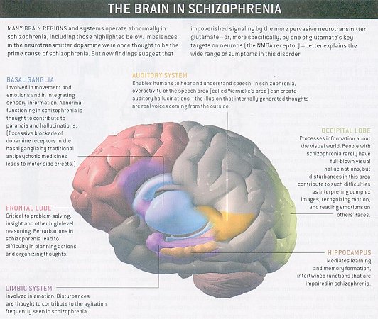 I10-62-schizophrenia.jpg